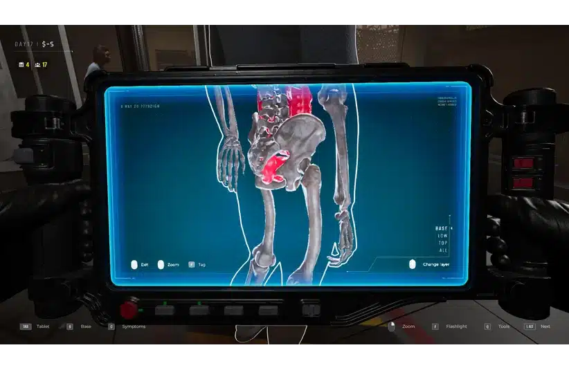 X-ray contraband angle two