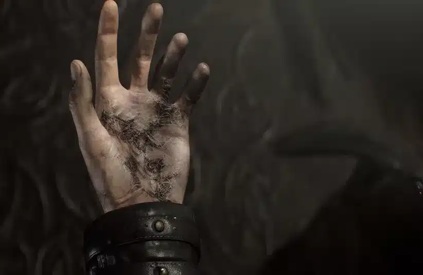 Leon's infection in his hand in Resident Evil Requiem