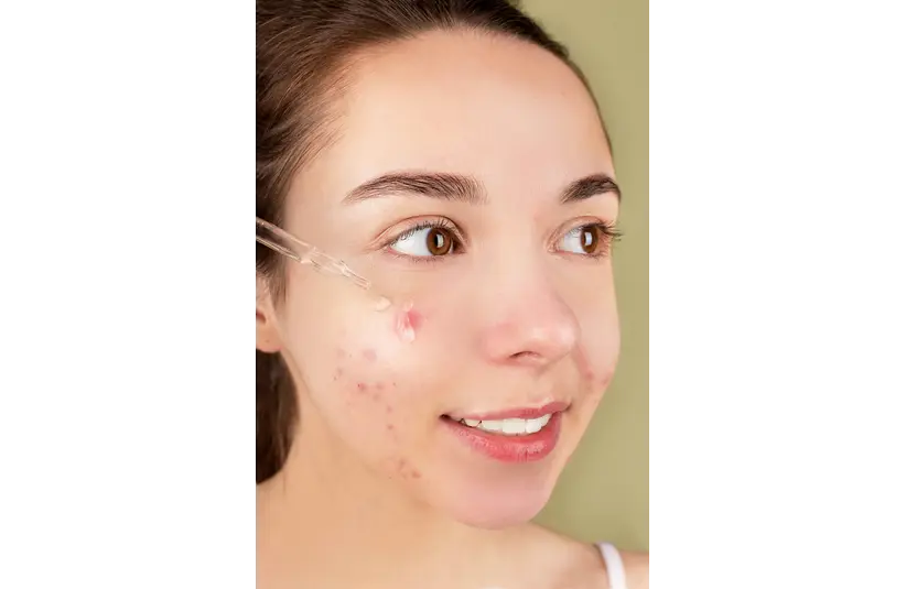 skin fatigue causes and solution